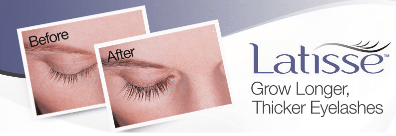 Latisse